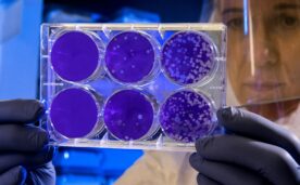La Nación: «If science doesn't listen, it becomes the new inquisition».»