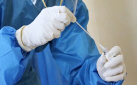 La experta de la Cátedra Laura Lechuga participa en el diseño de un biosensor fotónico que detecta siete marcadores biológicos en una muestra